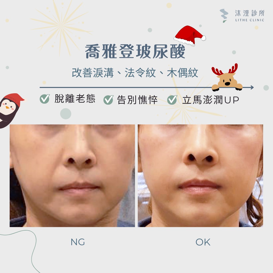喬雅登